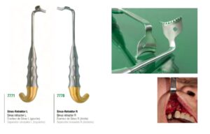 Sinus Retractor Set