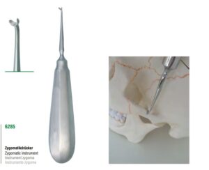 Zygomatic Instrument